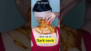 How to get rid of dark neck  black neck home remedies treatment shorts [upl. by Ardaed]