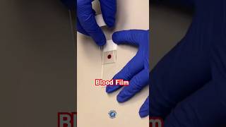 🪔🥰🥳Blood Film🩸🎉🪔 Shorts ShortsViralTV shorts shortsviral shortsvideo medical [upl. by Atires]