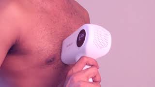 Men body permanent hair removing with Bosidin D1172 Laser device [upl. by Francklyn]