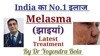 Melasma Latest amp best treatment By Dr Yogendra Bola [upl. by Aohsoj464]