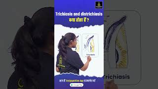 Trichiasis and districhiasis क्या होता हैं Ophthalmic districhiasis Trichiasis DOTClass eye [upl. by Debbra]