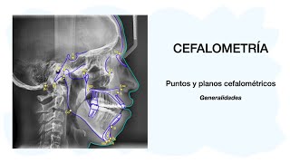 PUNTOS CEFALOMÉTRICOS  Cefalometría 💀🦷✅ [upl. by Sitoel]