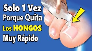 Echa este ACEITE 1 vez en tus PIES con HONGOS o BACTERIAS💅 Adiós HONGOS de las UÑAS en 2 días [upl. by Ayres]