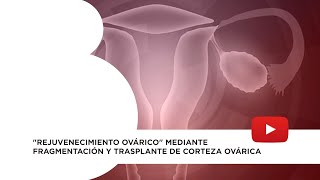 Técnicas de quotrejuvenecimiento ováricoquot Fragmentación de la corteza ovárica [upl. by Baldridge]