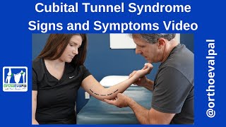 Cubital Tunnel Syndrome Signs and Symptoms [upl. by Trebliw]