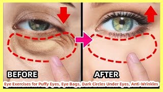 🔥 Bigger Eye Exercises for Puffy Eyes Eye Bags Dark Circles Under Eyes AntiWrinkles [upl. by Dde]