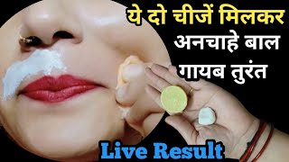 hard Chin hair👉पे सिर्फ इसे घिसके मोटे दिखे दाढ़ी मूछ पर लगाते ही गायब तुरंत😱 Facial Hair Removal [upl. by Airekat273]