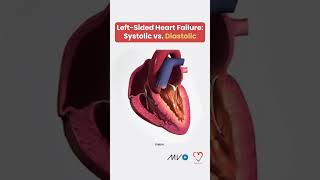 Systolic vs Diastolic Heart Failure 🫀 [upl. by Naji]