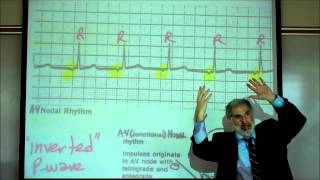 CARDIAC PHYSIOLOGY PART 3 by Professor Finkwmv [upl. by Sylado]