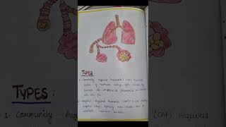 Case Study on pneumonia Nursing GNM Child Health Nursing Pediatric case presentation shorts [upl. by Beker]