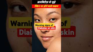 Warning signs of diabetes on skin diabetes diabetescare [upl. by Yffub]