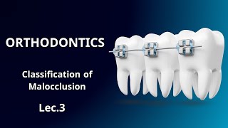 Orthodontics Classification of Malocclusion  تقويم الاسنان المحاضرة الثالثة [upl. by Arodal]