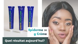 Mon avis sur épiderme 30g aujourdhui comment choisir sa crème de visage🙄🙄 [upl. by Kenweigh]