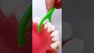 Best tool for teeth shortsvideo [upl. by Kieffer116]