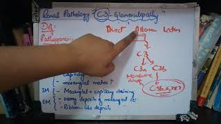 RENAL PATHOLOGY lecture 8 C3 GLOMERULOPATHY must watch to grab easily [upl. by Essirahc175]