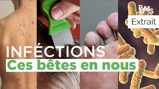 Les 4 petites bêtes qui nous infectent  Pour une meilleure santé pums [upl. by Leonard]