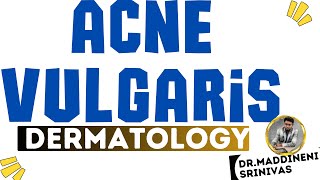 ACNE VULGARIS  Causes Risk factors Clinical features Mx  Dr Maddineni Srinivas  DrMSD  TS KNRUHS [upl. by Twum]