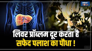 White Palash Plant लिवर की गंभीर बीमारी का रामबाण इलाज है सफेद पलाश का पौधा  Liver Disease [upl. by Ennoitna]