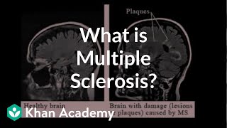 What is multiple sclerosis  Nervous system diseases  NCLEXRN  Khan Academy [upl. by Anthia]