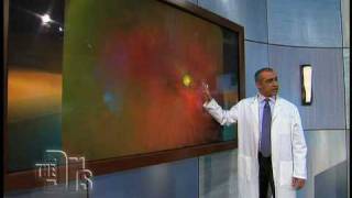 The Optomap® Retinal Exam on The Doctors [upl. by Adnawt205]