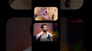 Skinless vs SkinOn Which Chicken Wins  Telugu Podcast  Voice of Mogasala [upl. by Onstad330]