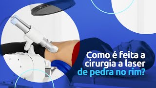 Como é feita a cirurgia a laser de pedra no rim [upl. by Enidlarej]