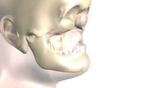 NearTotal Face Transplant Surgical Animation [upl. by Aible812]