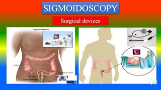 SIGMOIDOSCOPY Definition  parts uses  Precautions How to use   Surgical Devices [upl. by Steffie756]