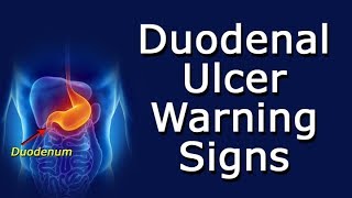 Duodenal Ulcer Warning Signs [upl. by Banky]