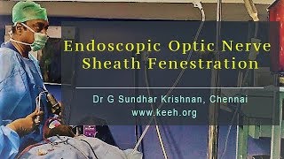 Endoscopic Optic Nerve Sheath Fenestration  Dr G Sundhar Krishnan Chennai [upl. by Tigirb461]