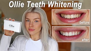 Ollie Teeth Whitening Strips better then HiSmile  a very honest review [upl. by Ednew864]