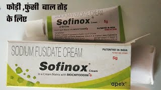 Sofinox Cream Uses Hindi  Sofinox cream  Sodium Fusidate 2 फोड़ी फुंसी के लिए बहुत ही बढ़िया इलाज [upl. by Sarazen965]