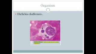 Ehrlichiosis An integrated discussion for USMLE step 1 [upl. by Yeknarf]