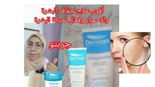 Dermagor Atopicalm كريم فعال👌يخلي وجهكبلارة مجربلعلاج التهيج والتشققاتواقي شمسي الحساسية [upl. by Lien]