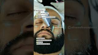 Live Hydraglow Mens Instant Skin Glow  Live Skin Whitening Treatment  Delhi shorts [upl. by Eiznikam]