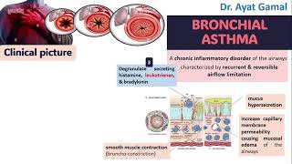 Signs and symptoms of bronchial asthma in brief for dentists [upl. by Nalloh]