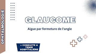 Glaucome aigue par fermeture de langle Rappel physiopathologie formes cliniques DC positif CAT [upl. by Gonroff]