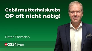 Die grosse Angst mit dem PAP Abstrich  Facharzt Peter Emmrich  Erfahrungsmedizin  QS24 [upl. by Ludwig]