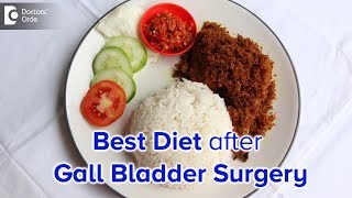 Diet after Laparoscopic Cholecystectomy Gall bladder surgery  Dr Nanda Rajaneesh [upl. by Monroe433]