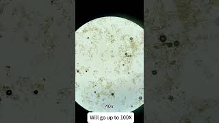 Saliva under the microscope saliva microscope undermicroscope bacterialdiseases candidiase lab [upl. by Kai]