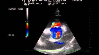 Herzultraschall Aortenklappeninsuffizienz beim Pferd [upl. by Noyes]