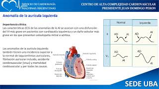 Electrocardiograma Parte 2 [upl. by Hummel]