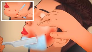 ASMR Shaving and Ingrown Hair Removal Animation Tingle Sound [upl. by Pump]