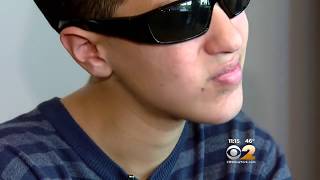 Vape Pen Explodes In Teen’s Face [upl. by Ballman831]