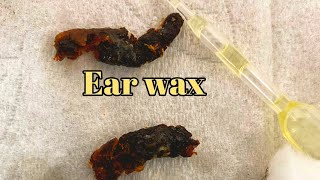 Earwax cerumen is yellowish waxy [upl. by Airetas]