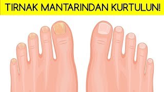 MANTAR KARARMADAN NASIL PÄ°ÅžÄ°RÄ°LÄ°R ve NASIL TEMÄ°ZLENÄ°R MANTARLI SOÄžUK MEZE TARÄ°FÄ° [upl. by Erdman]