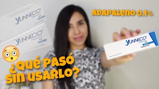 DEJE DE USAR ADAPALENO POR 1 MES Y ESTO PASO🫢‼️ [upl. by Neeloj]