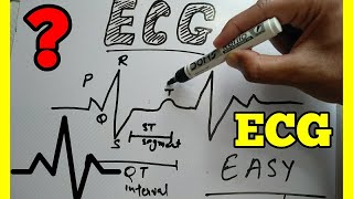 How to Read ECG in Hindi easy wayECG reading in Hindi ECG interpretation make easy ECG [upl. by Arretnahs]