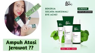 Review Everwhite Acne Pair  Kurang Cocok Di Type Skin Seperti Aku [upl. by Starlene]