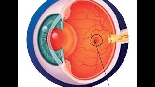 CÓMO EVITAR LA DEGENERACIÓN MACULAR ASOCIADA A LA EDAD Así como la baja visión [upl. by Nosimaj]